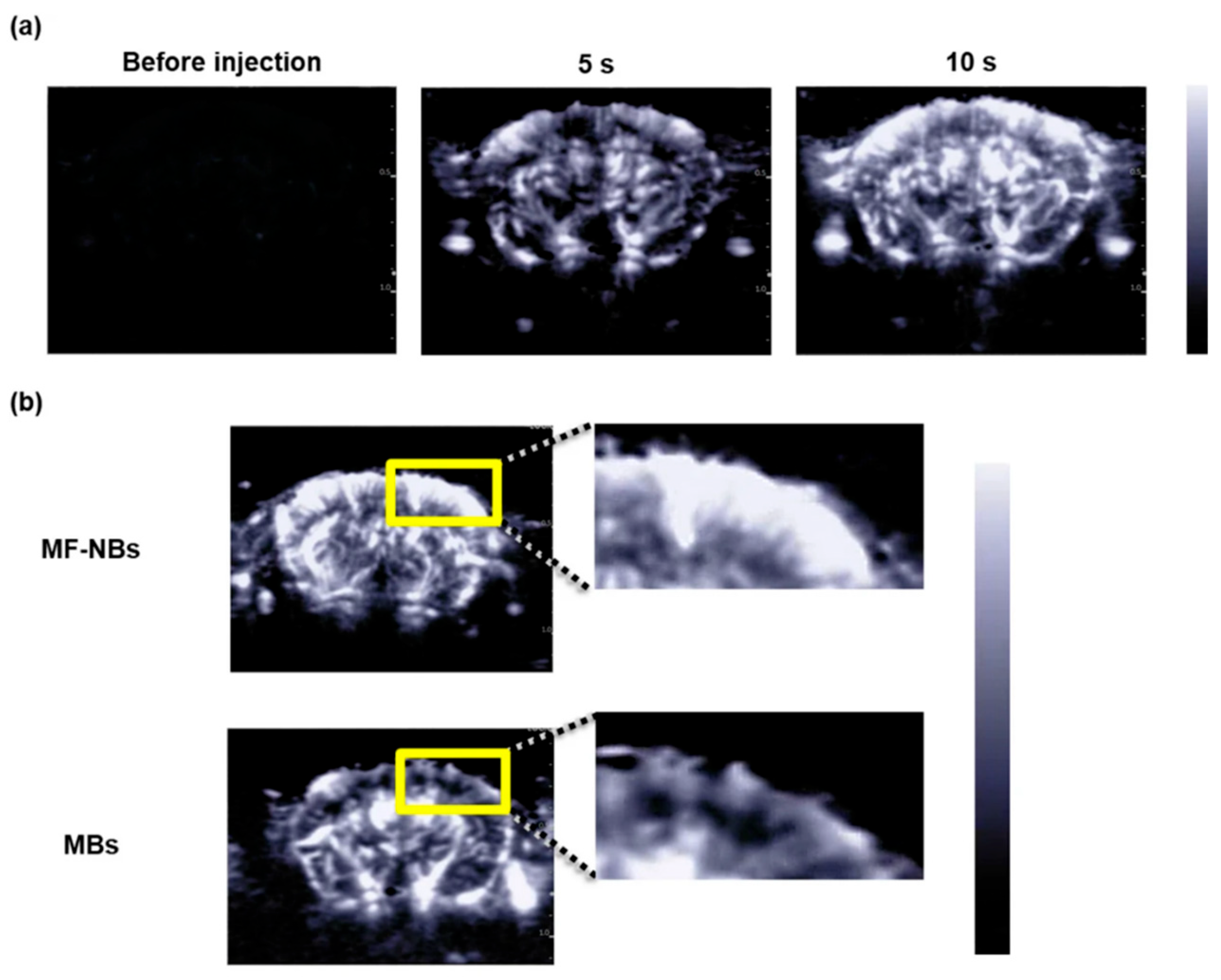 Biosensors 15 00809 g006 Biosensors 15 00809 g006