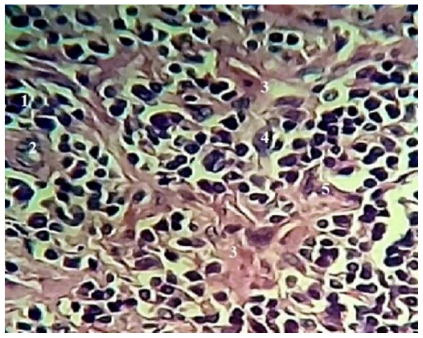 Blsf 22 00008 g001 550