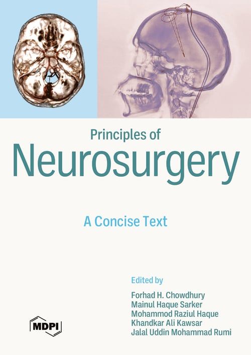 Principles of Neurosurgery