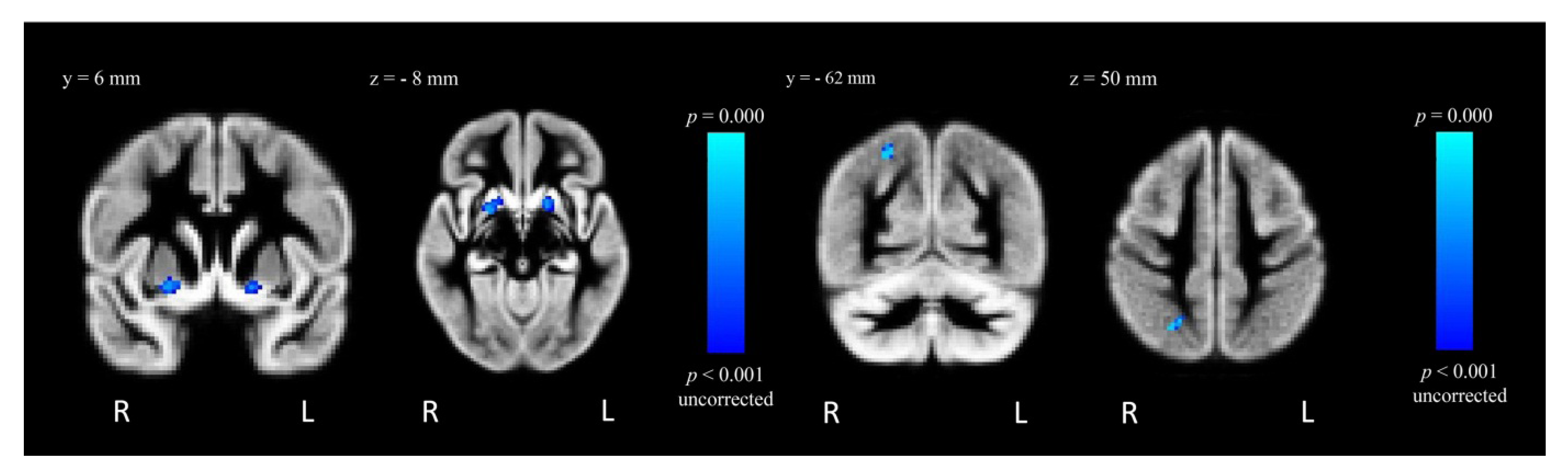Brainsci 02 00553 g004
