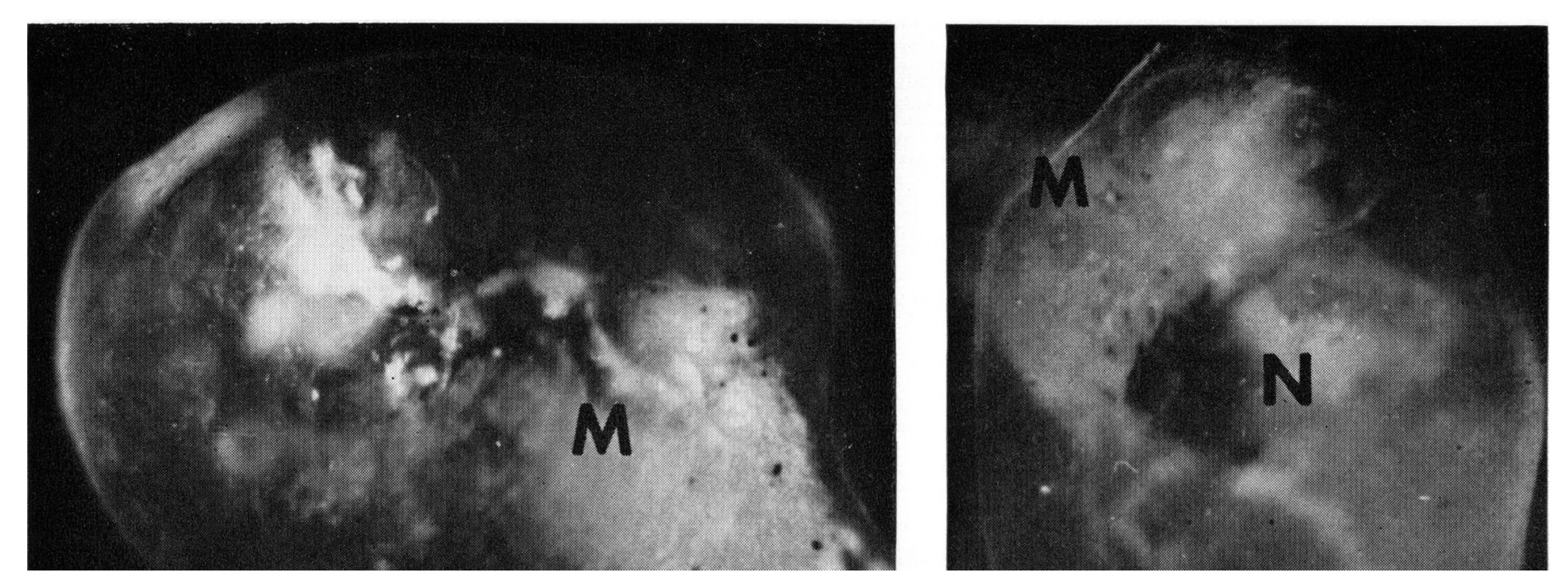 Brainsci 03 00800 g002