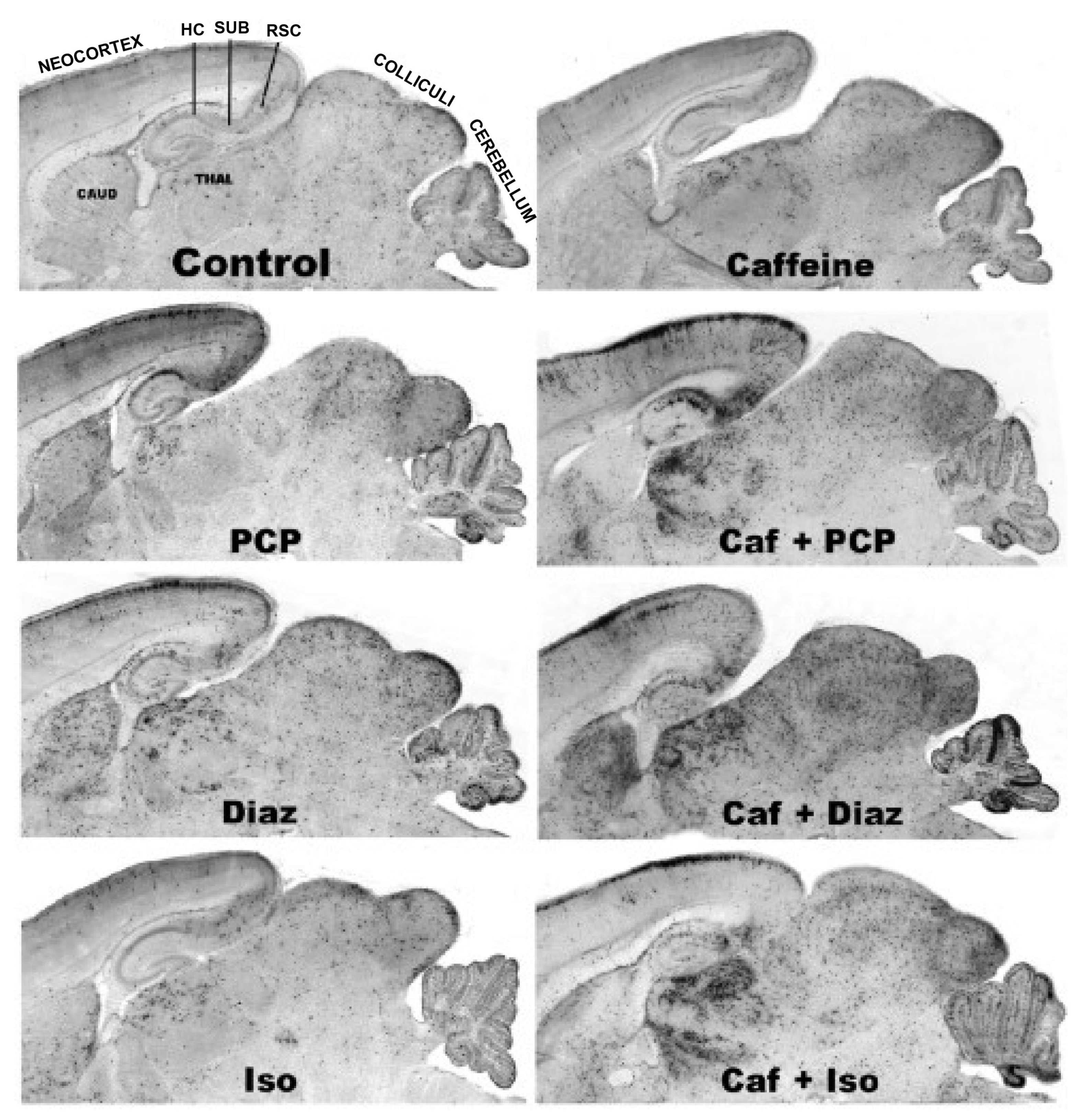 Brainsci 03 01128 g005 1024