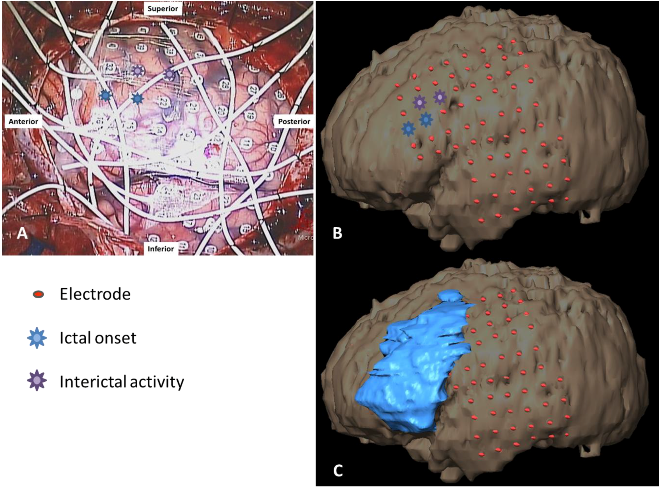 Brainsci 03 01597 g005 1024