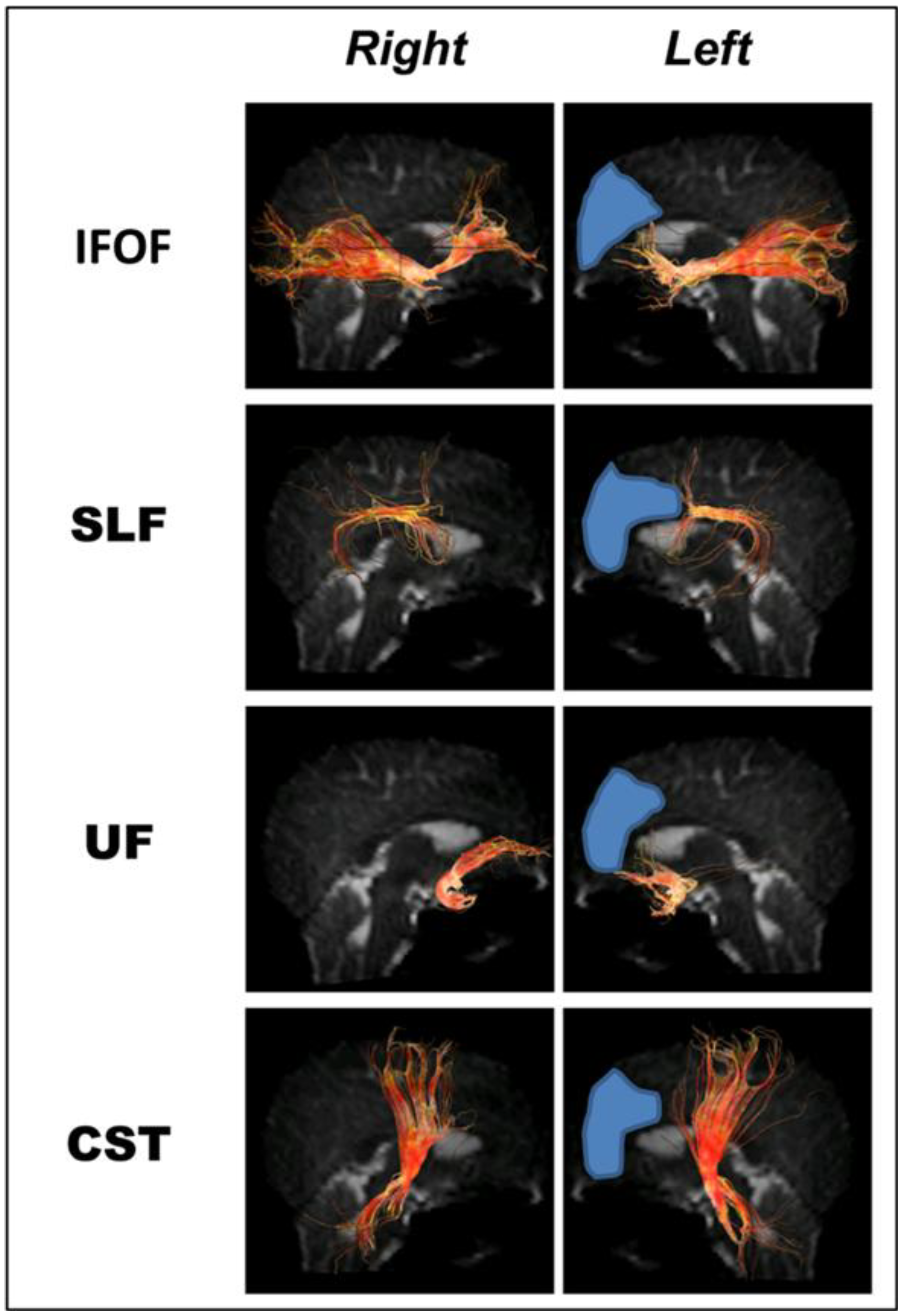 Brainsci 03 01597 g006 1024