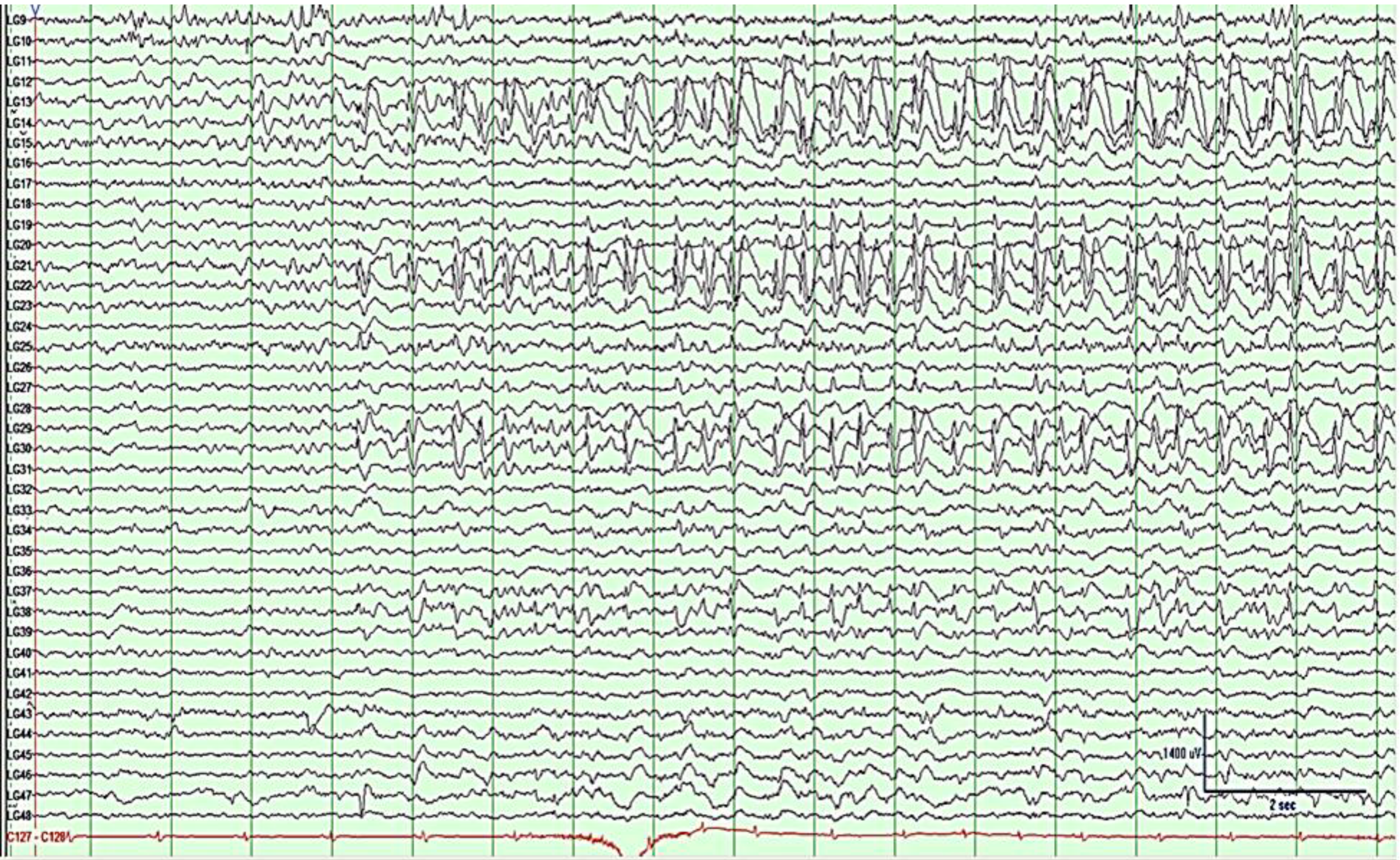 Brainsci 03 01597 g007 1024