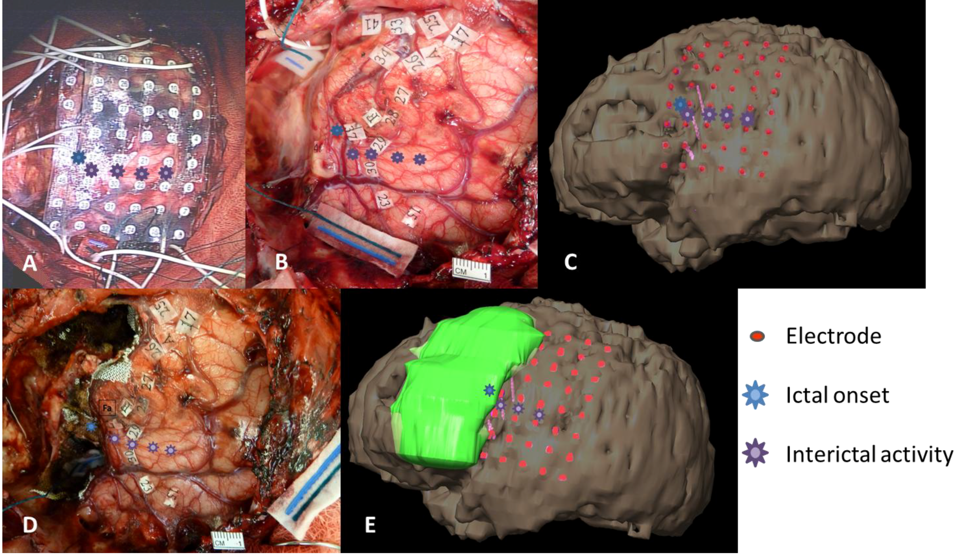 Brainsci 03 01597 g008 1024