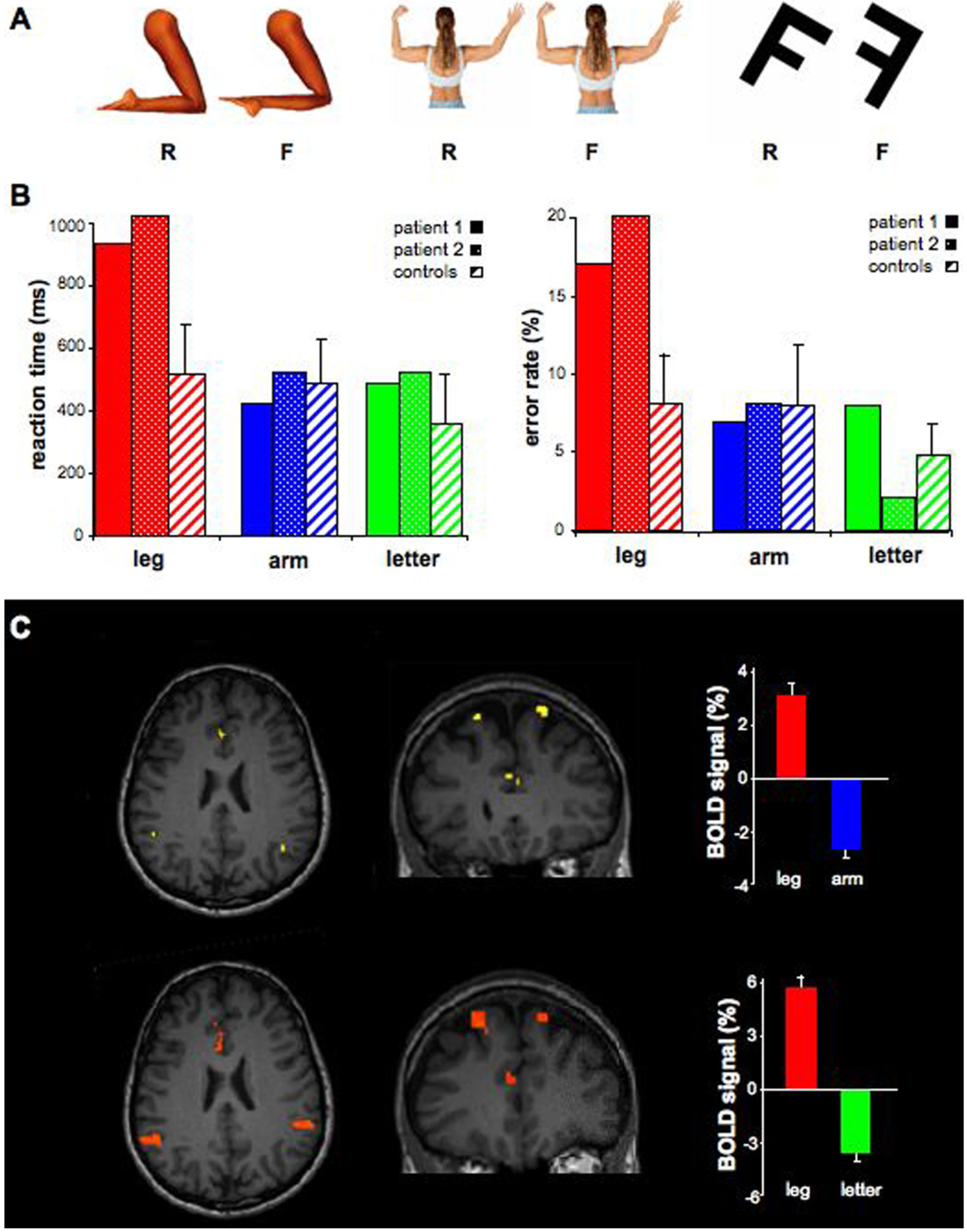 Brainsci 04 00396 g002