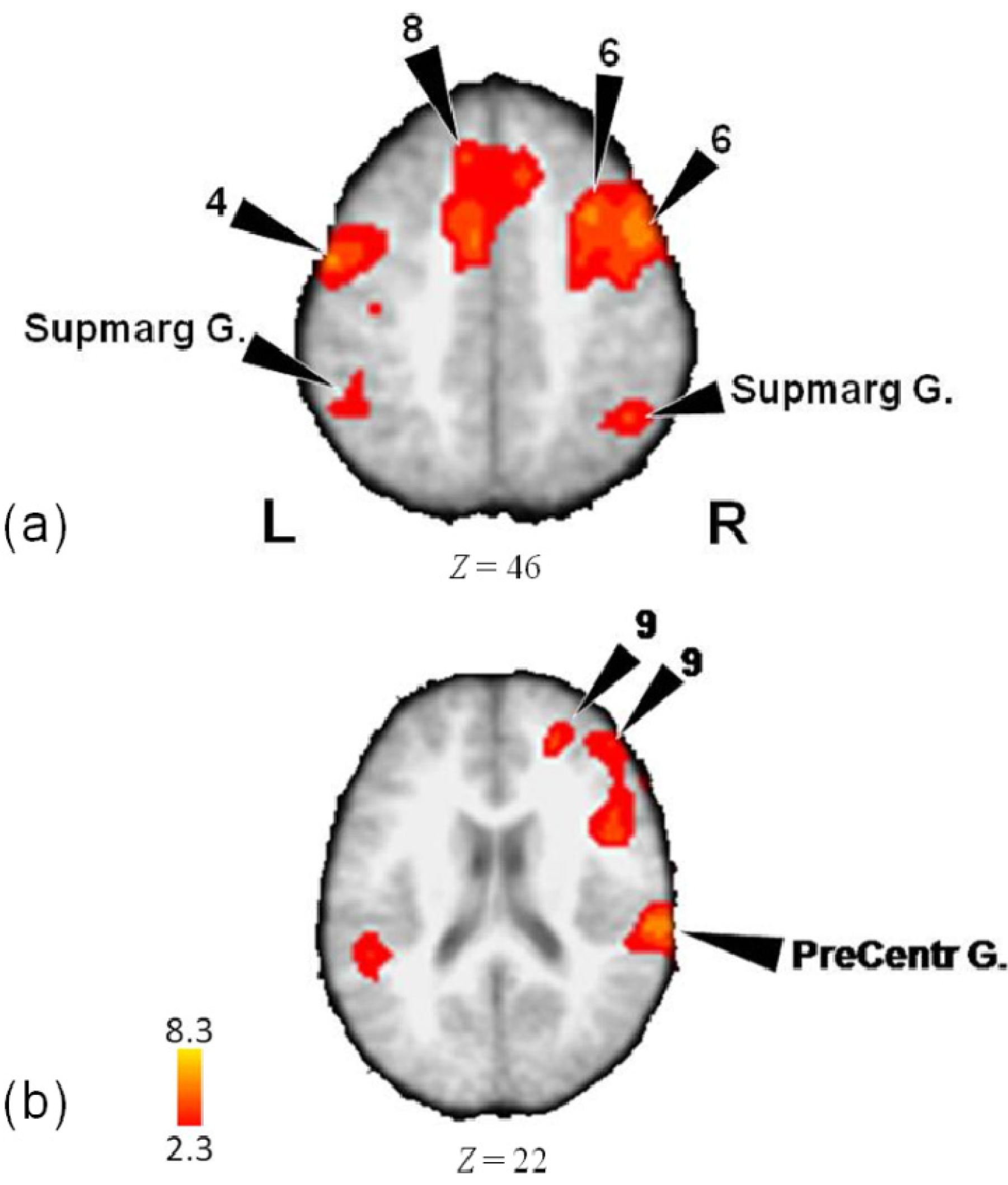 Brainsci 04 00428 g002
