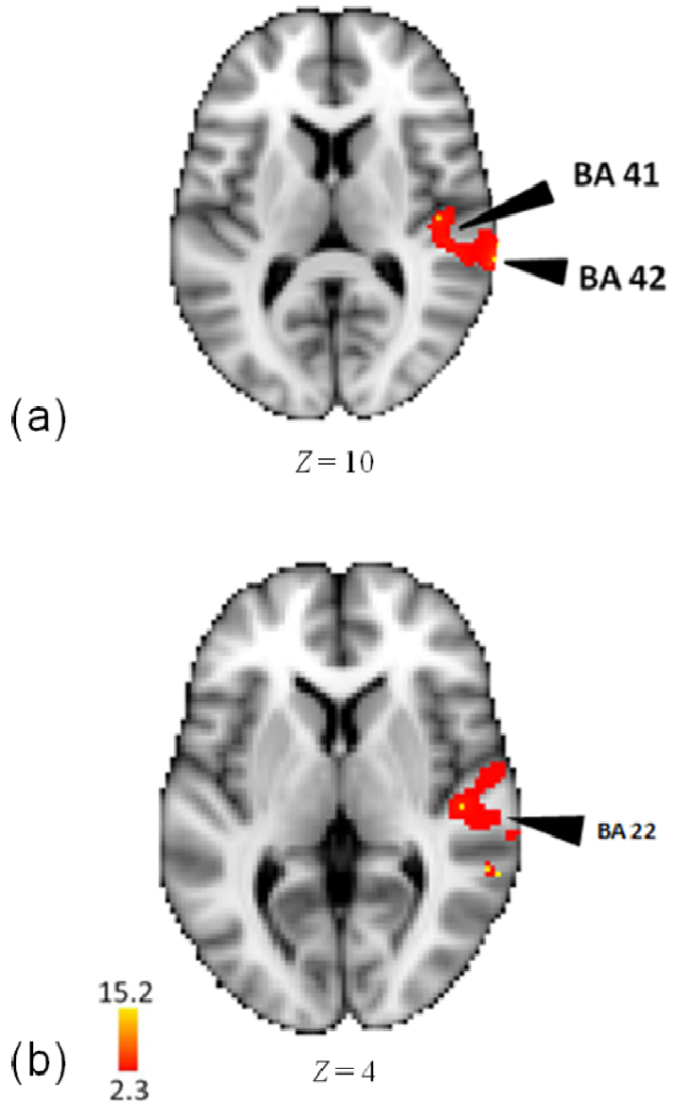 Brainsci 04 00428 g003