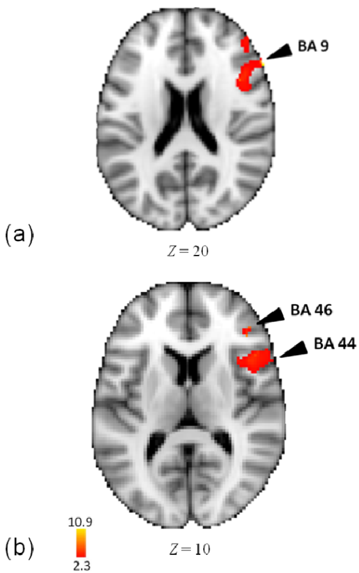 Brainsci 04 00428 g004