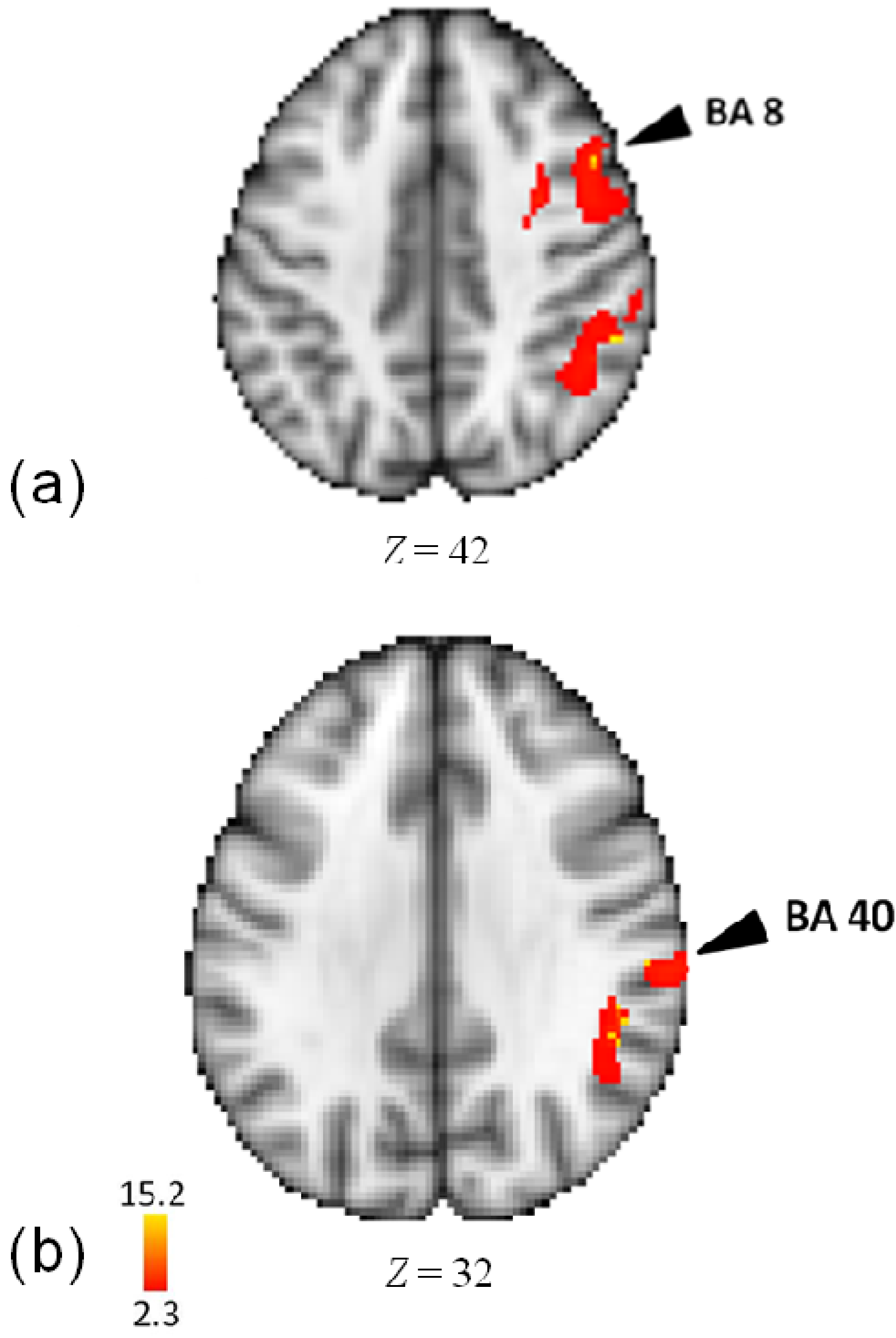 Brainsci 04 00428 g005