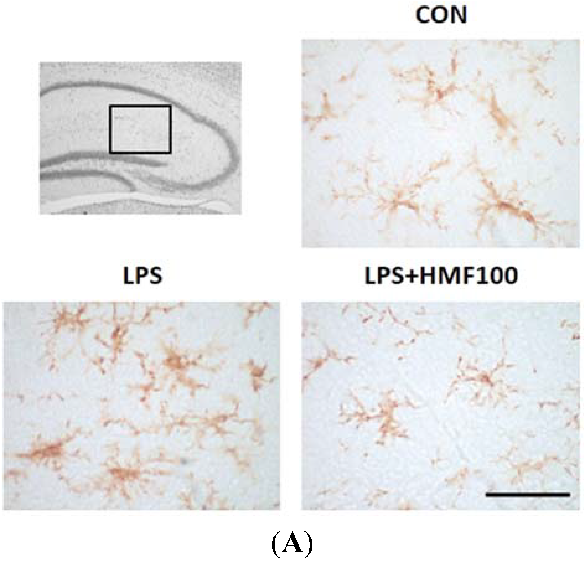 Brainsci 05 00118 g003a 1024