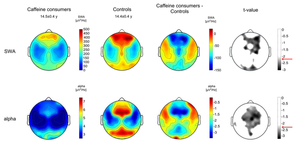 Brainsci 05 00441 g003 1024