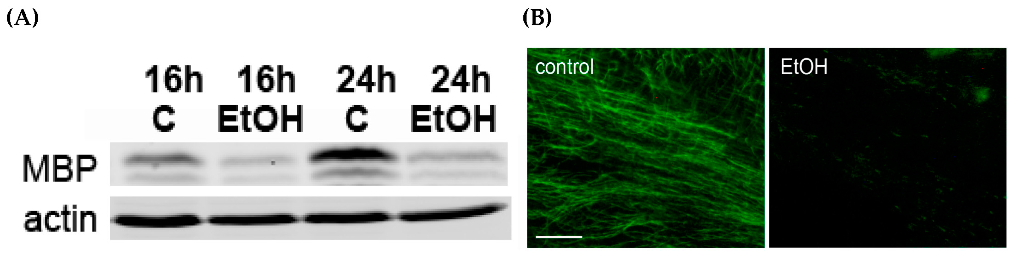 Brainsci 06 00031 g002