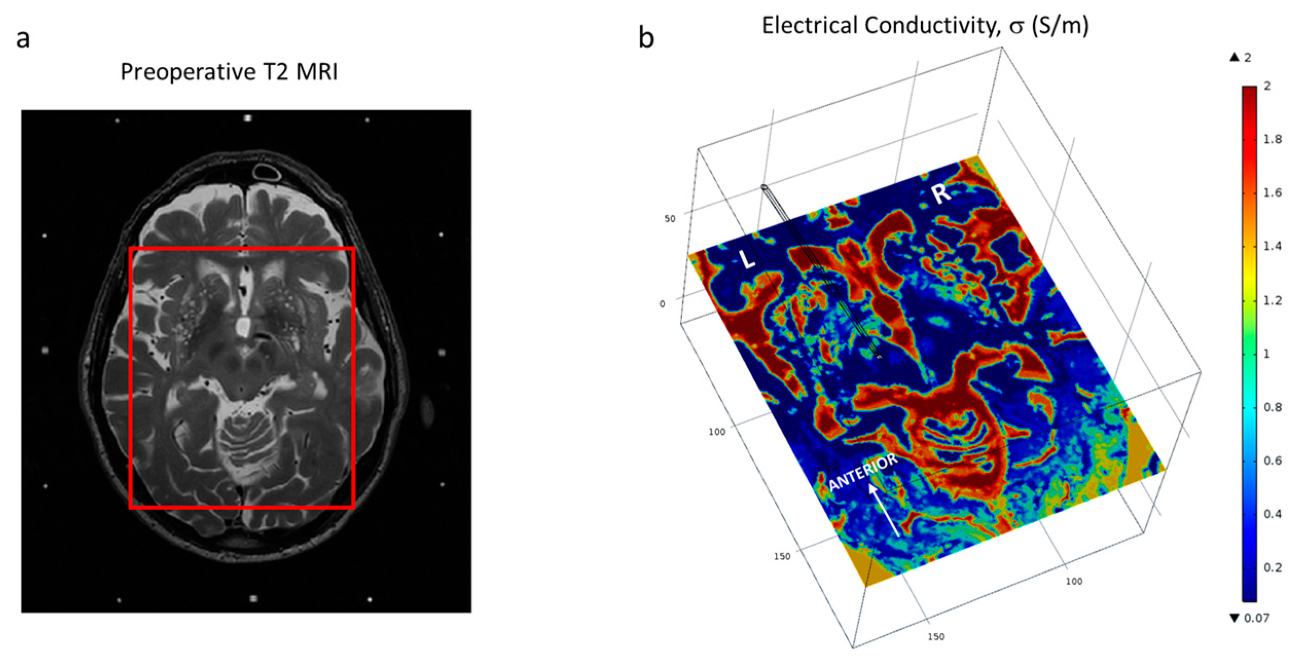 Brainsci 06 00039 g002