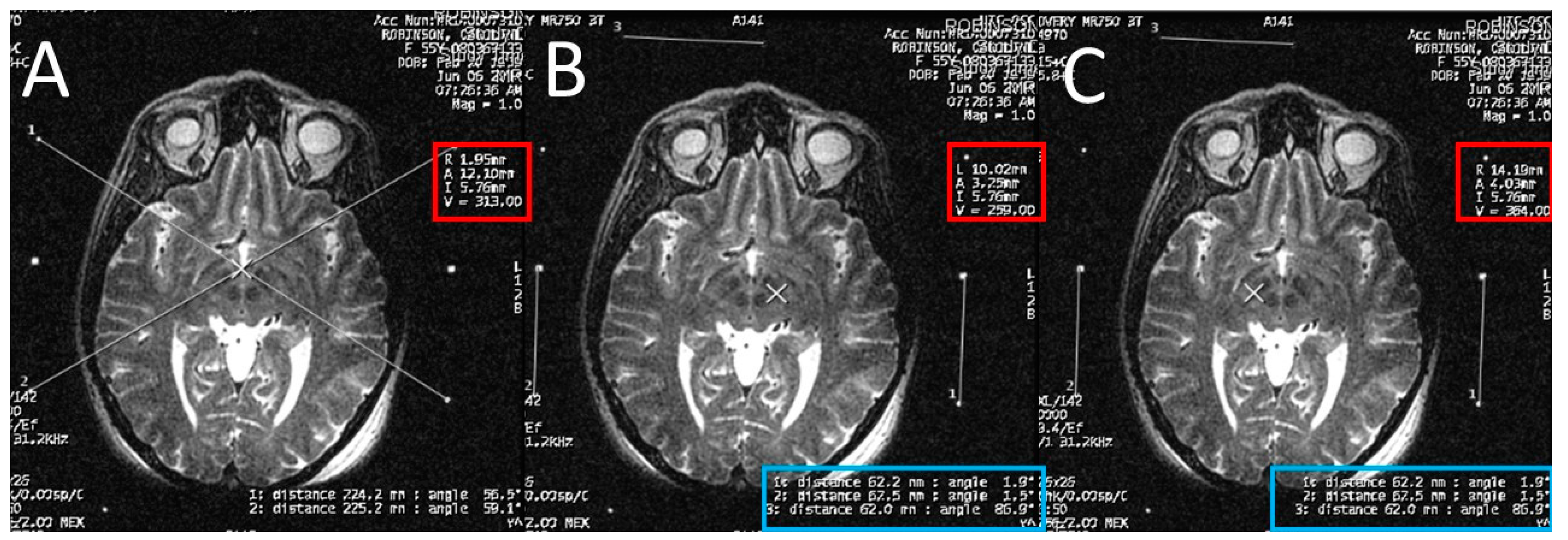 Brainsci 06 00058 g005 550