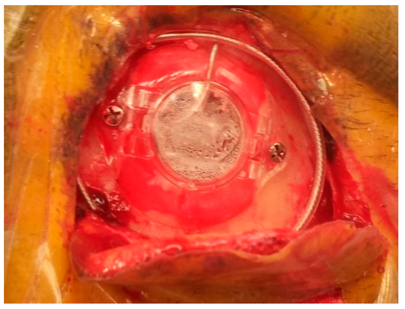 Brainsci 06 00058 g013 550