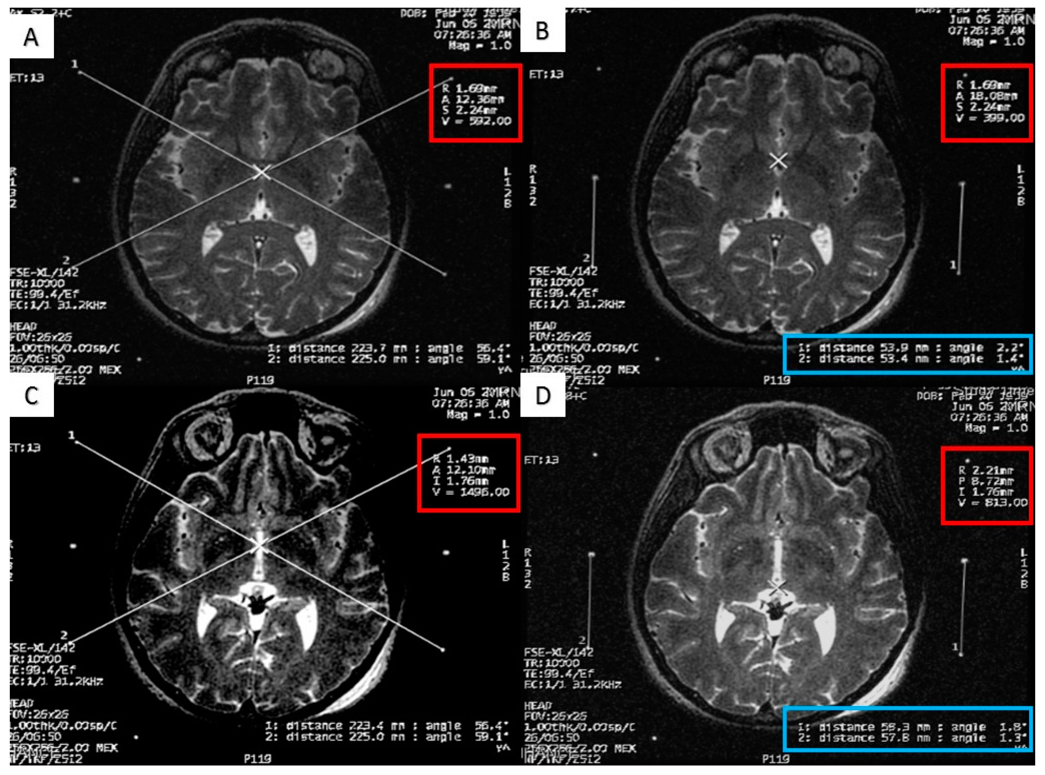 Brainsci 06 00065 g003 550