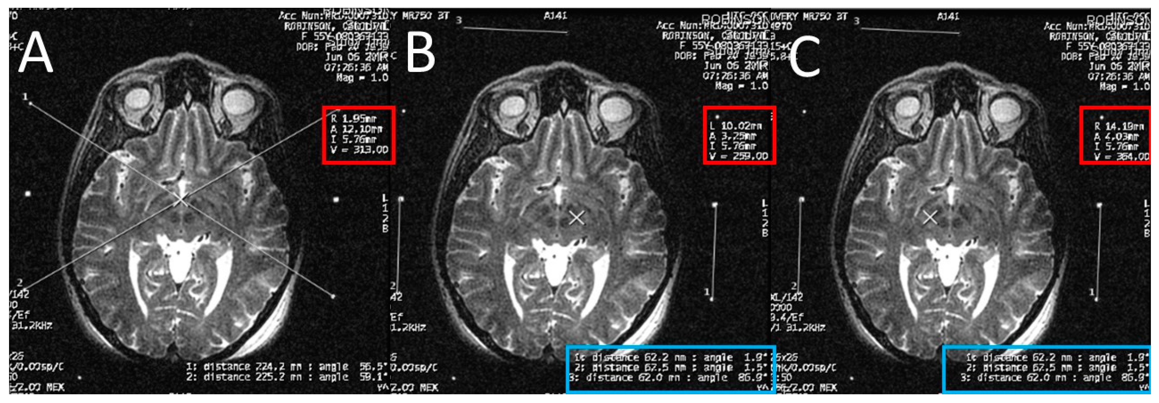 Brainsci 06 00065 g004 550
