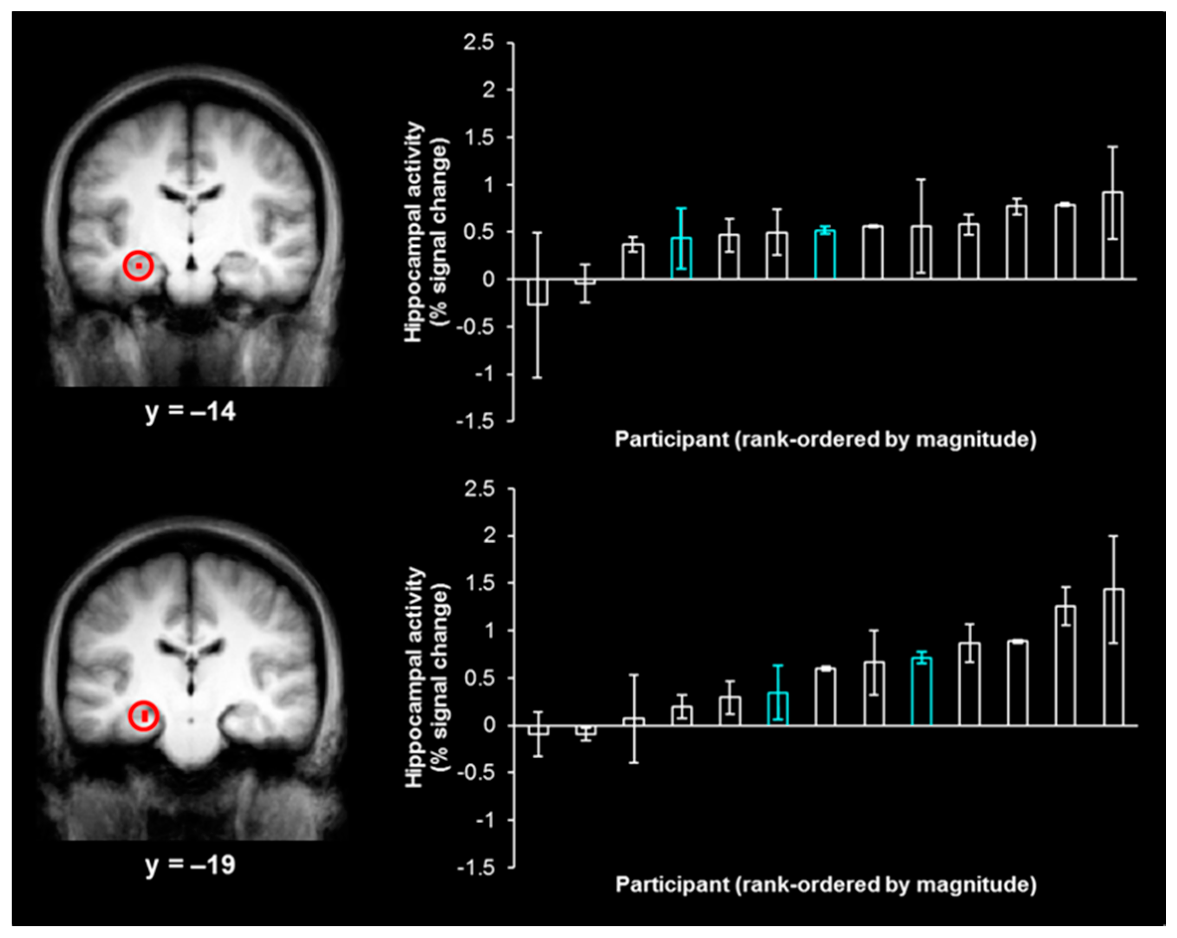 Brainsci 07 00013 g002