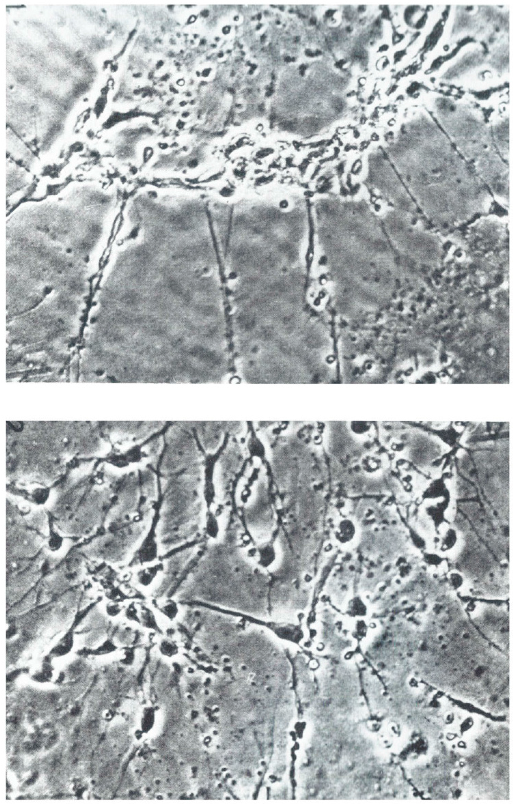 Brainsci 07 00020 g001