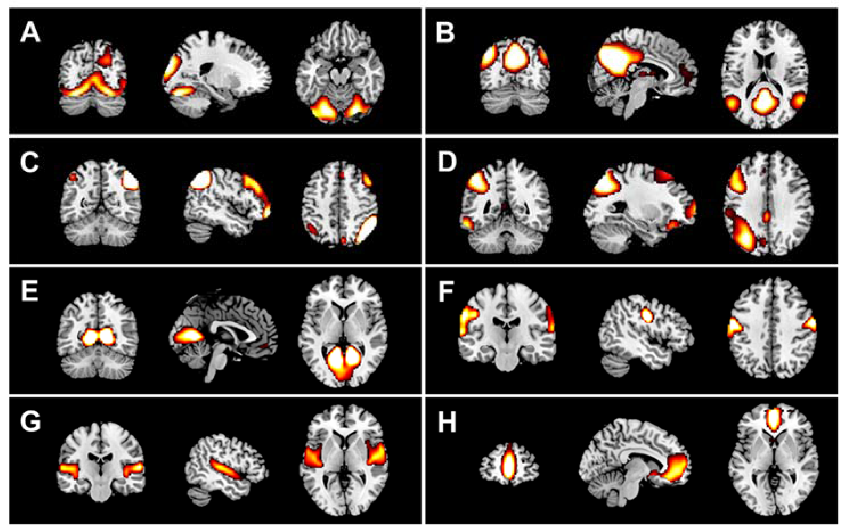 Brainsci 07 00050 g005