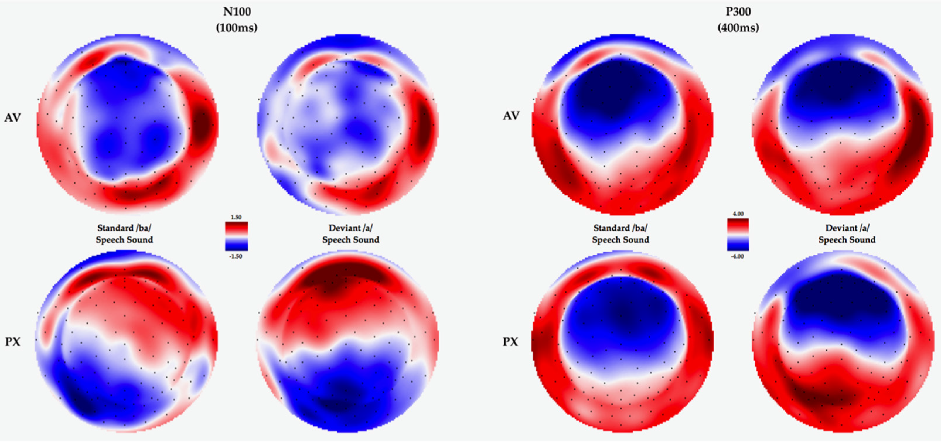 Brainsci 07 00060 g004 550