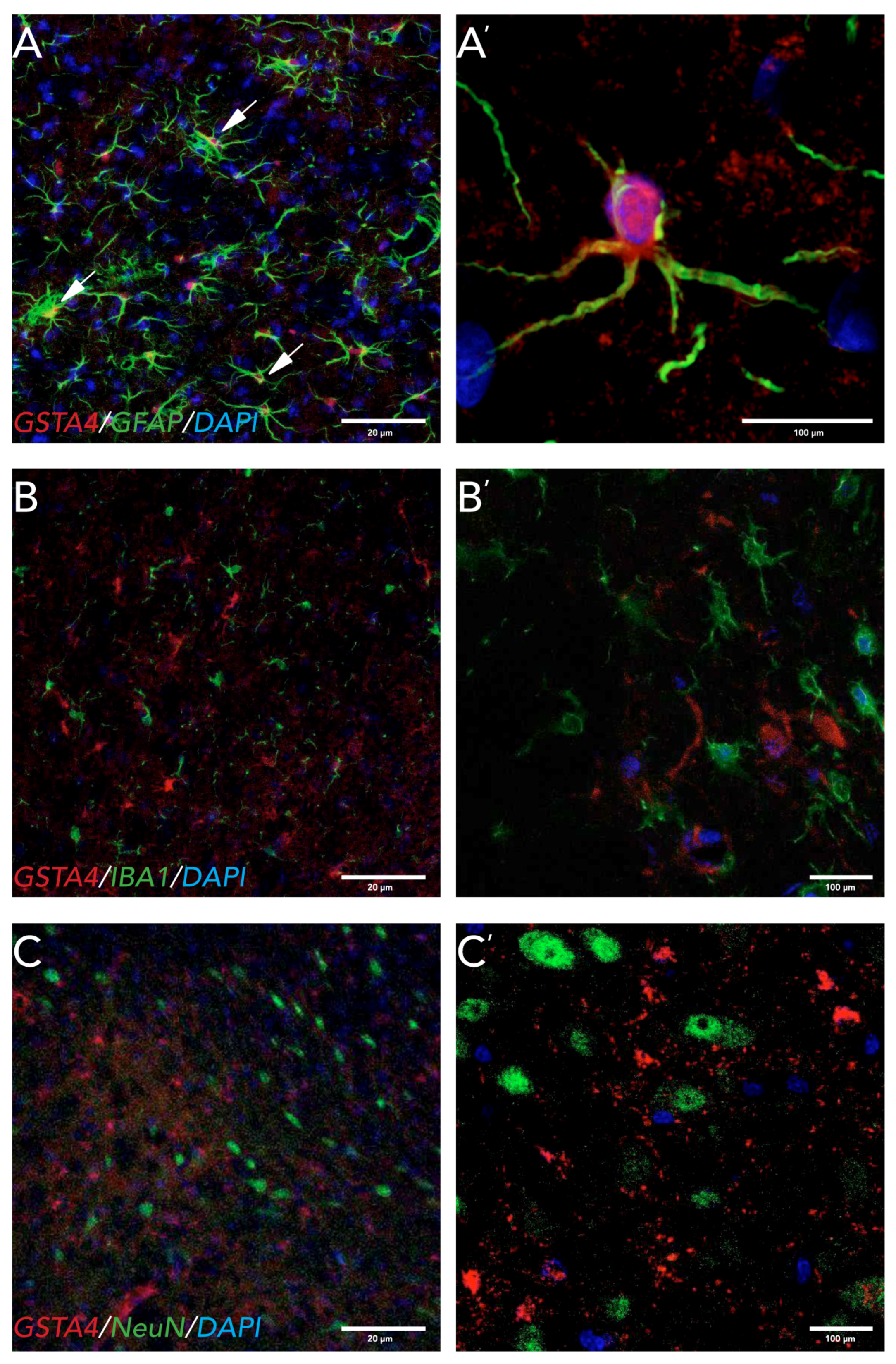 Brainsci 07 00073 g004