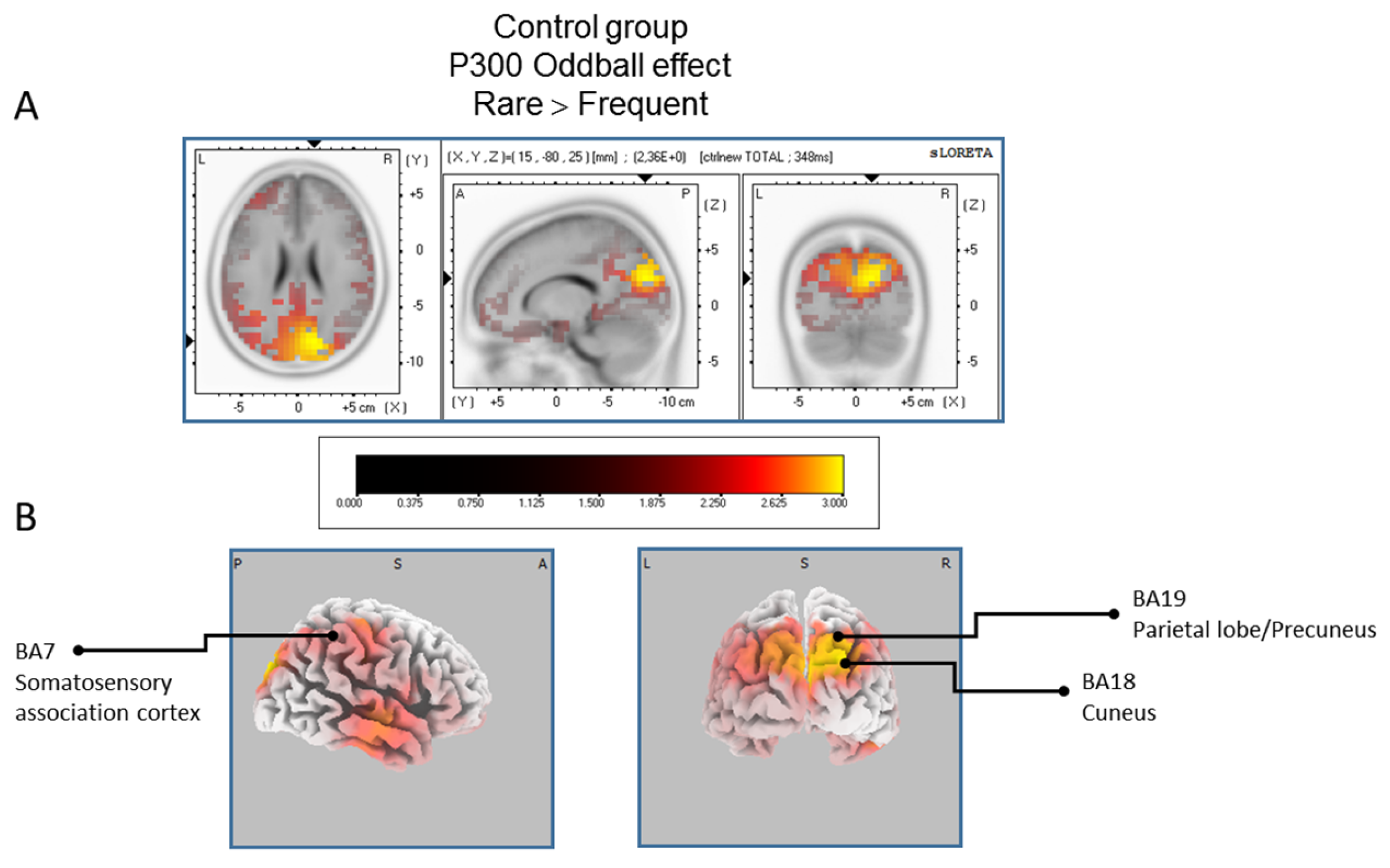 Brainsci 07 00076 g004
