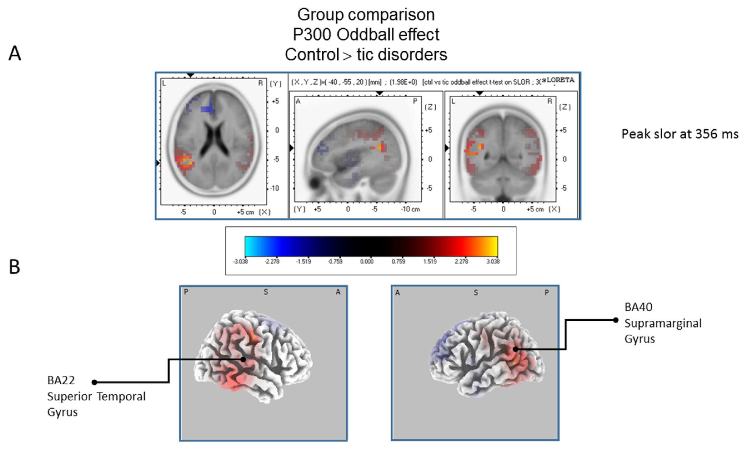 Brainsci 07 00076 g007