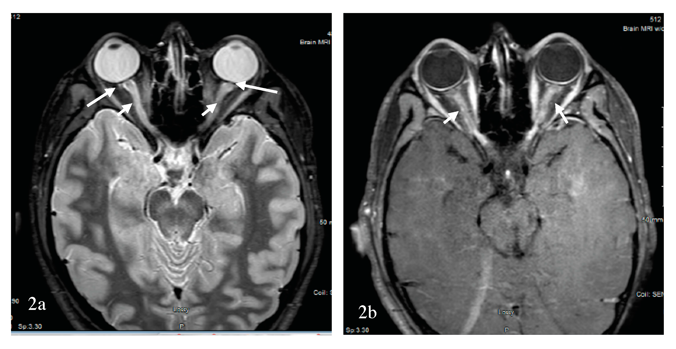 Brainsci 07 00138 g002 Brainsci 07 00138 g002