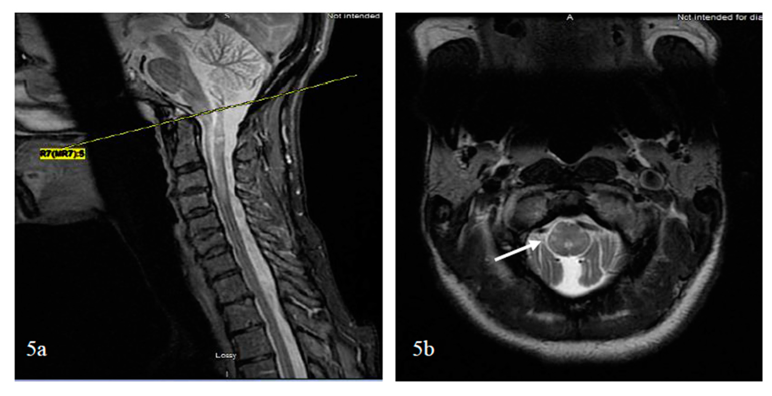 Brainsci 07 00138 g005 Brainsci 07 00138 g005