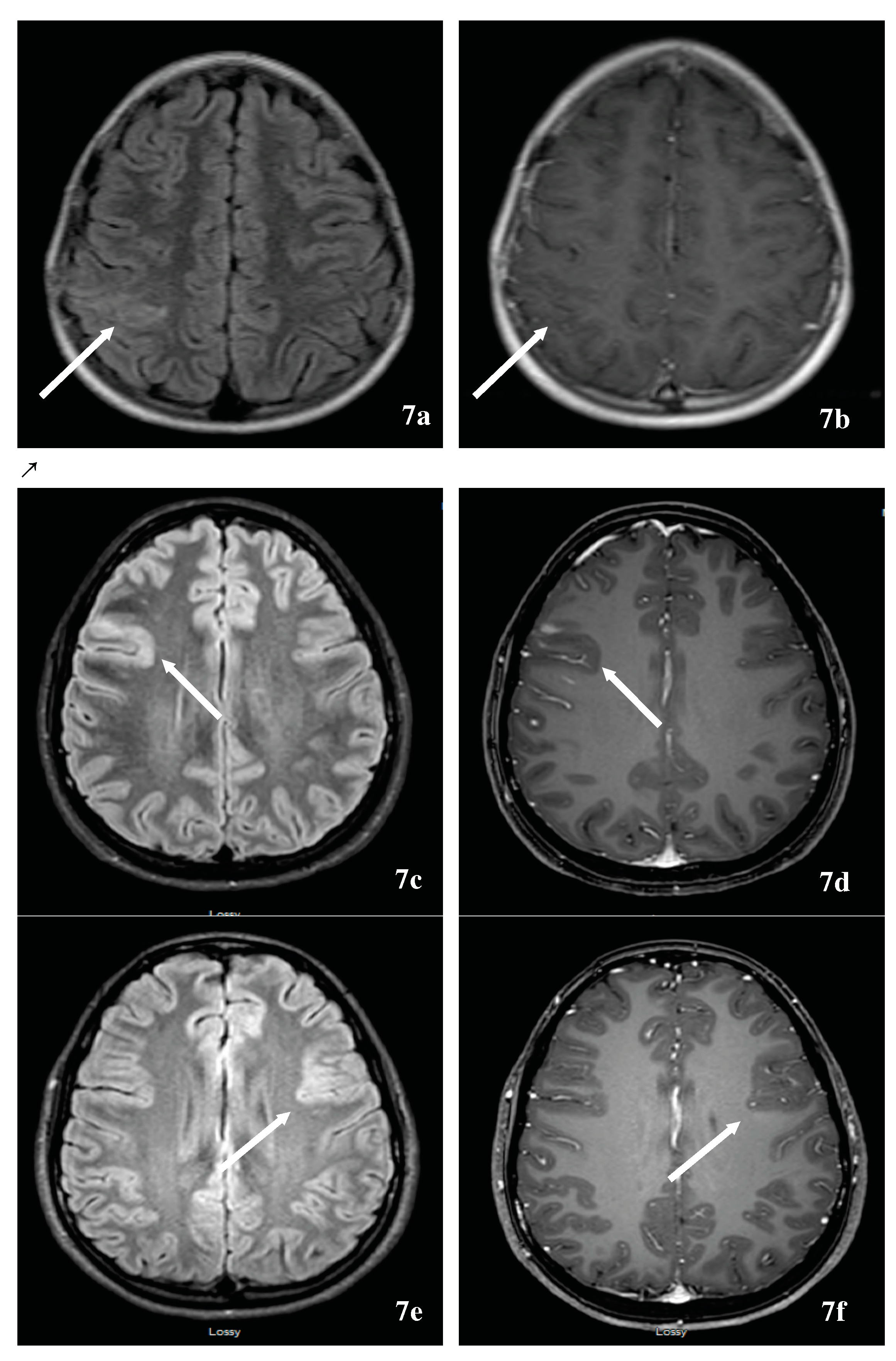 Brainsci 07 00138 g007 Brainsci 07 00138 g007
