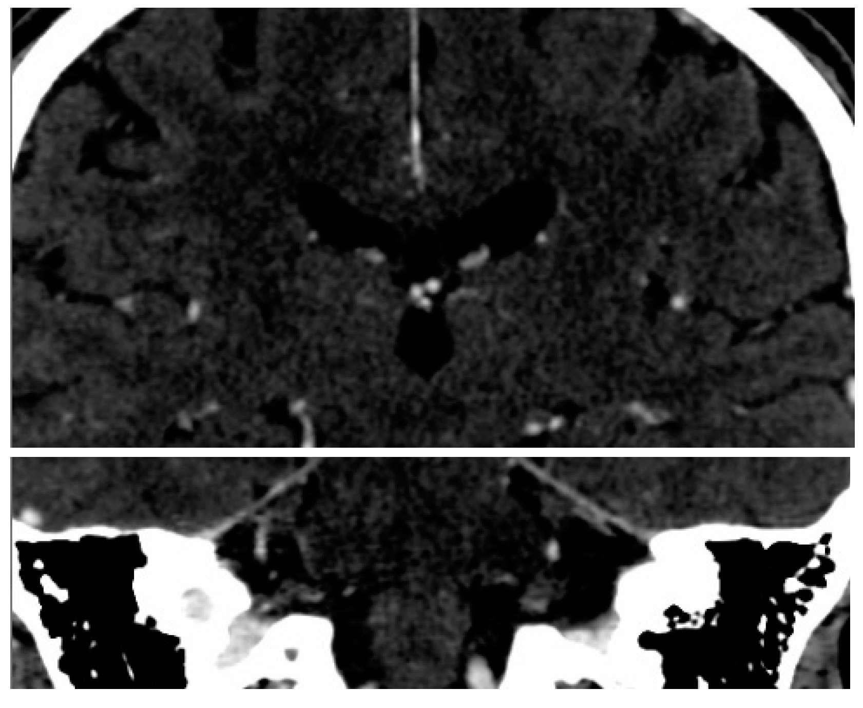 Brainsci 07 00155 g001