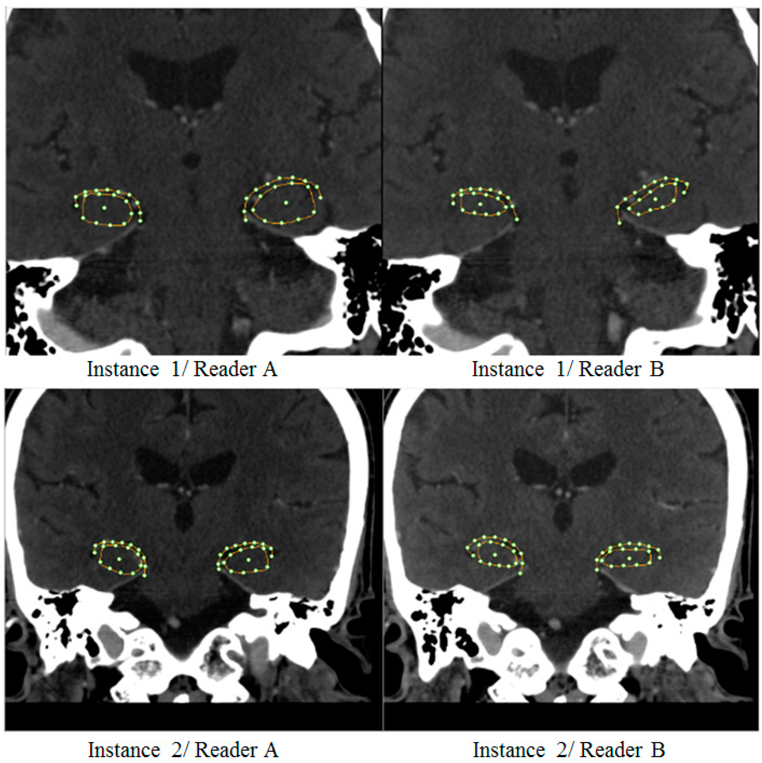 Brainsci 07 00155 g003