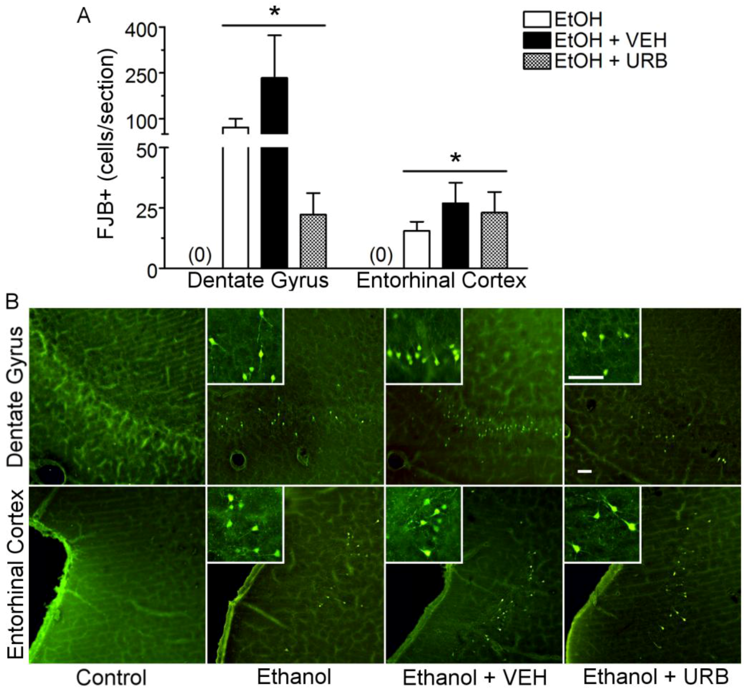 Brainsci 07 00158 g004 Brainsci 07 00158 g004