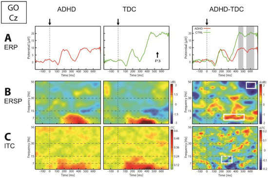 eeg adhd eeg adhd