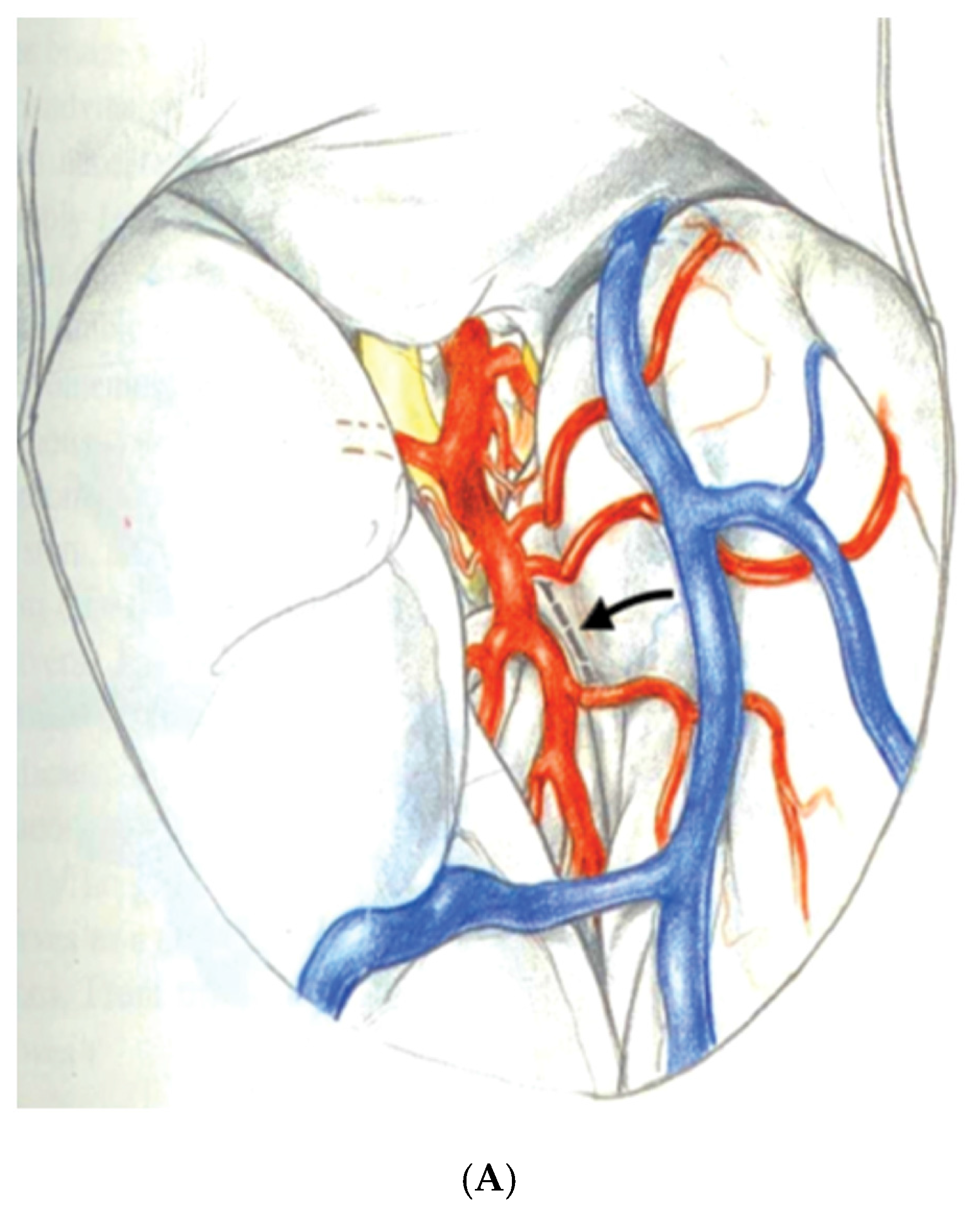 Brainsci 08 00035 g003a Brainsci 08 00035 g003a