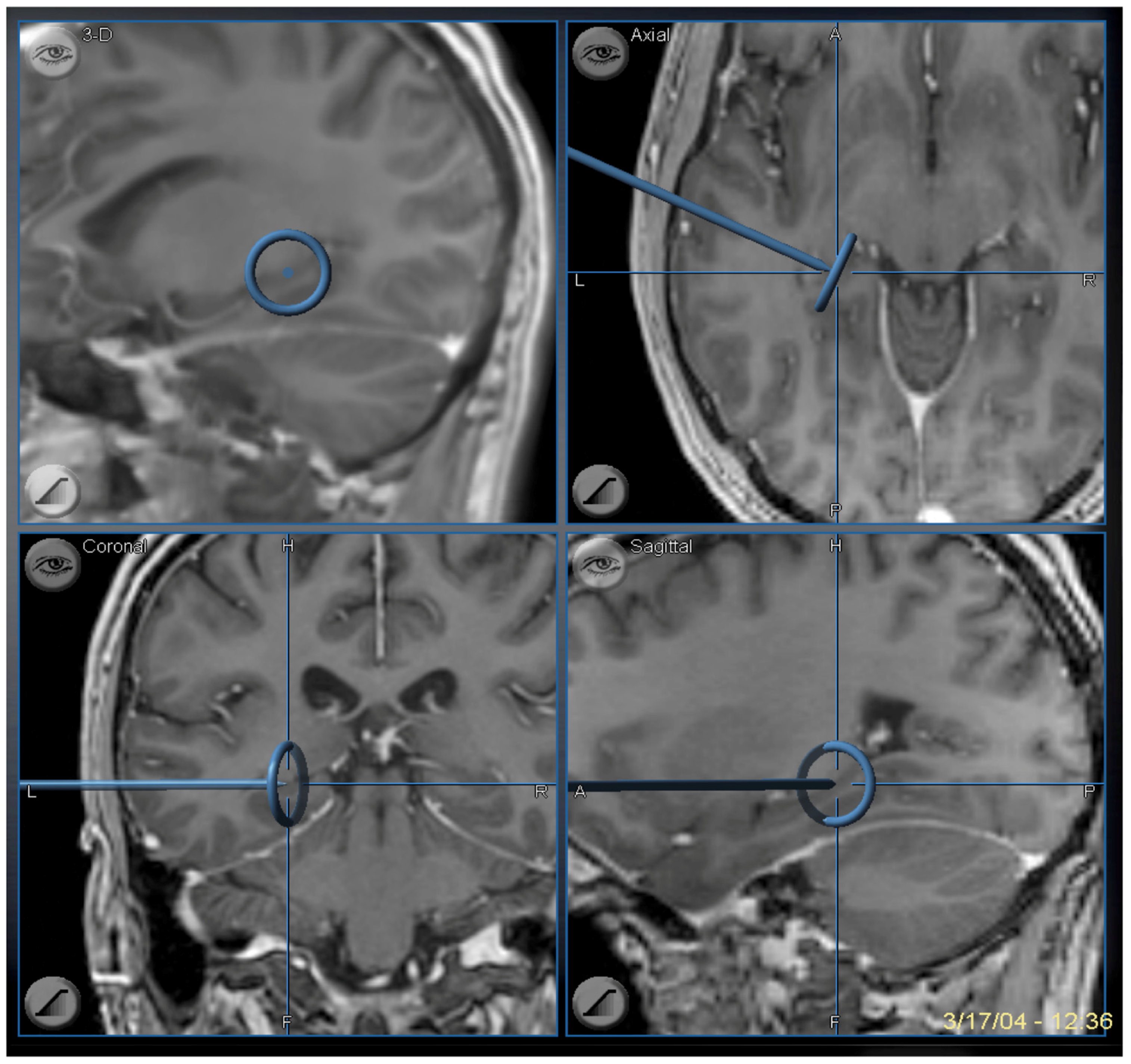 Brainsci 08 00035 g009 Brainsci 08 00035 g009