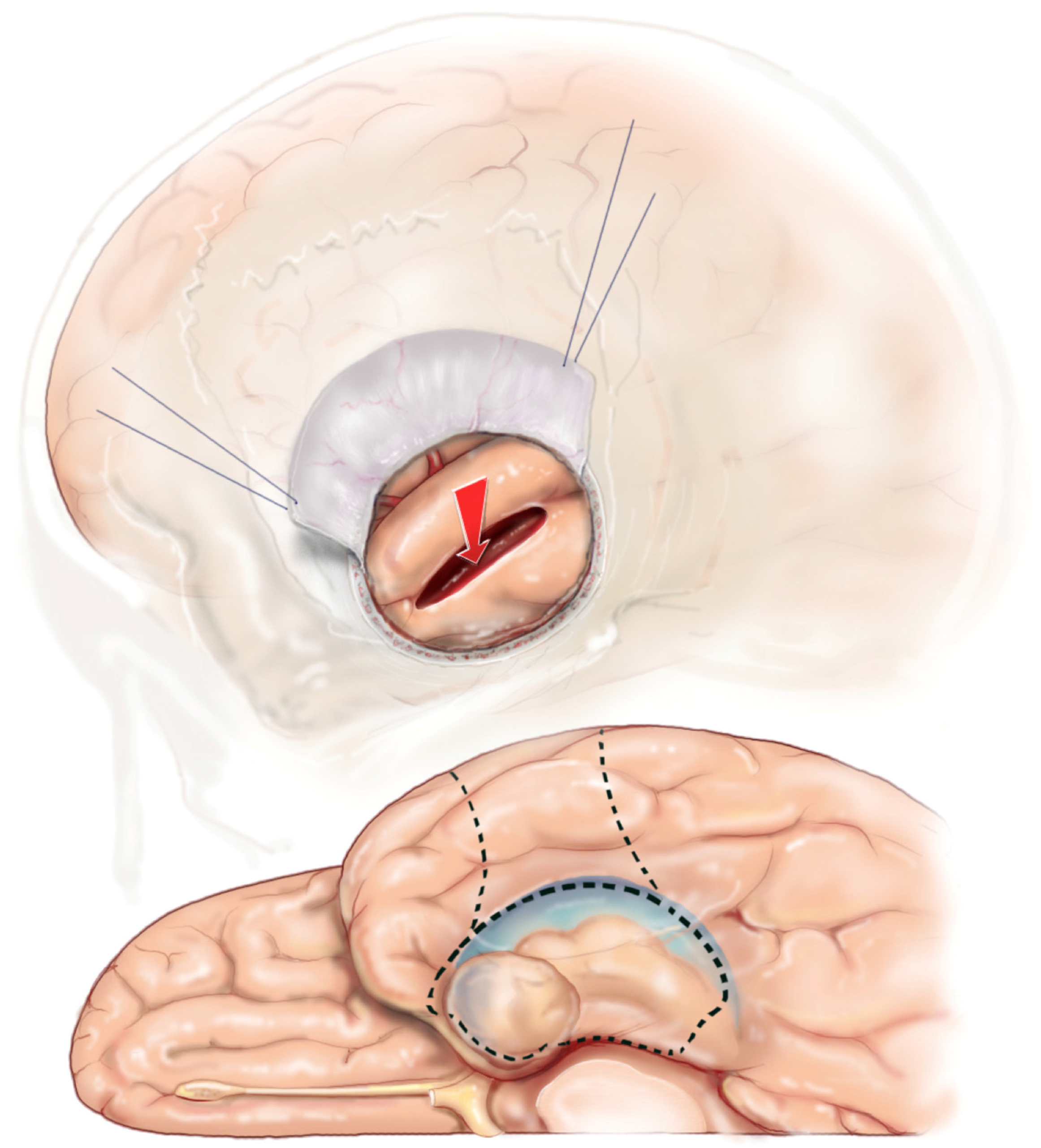 Brainsci 08 00035 g011 Brainsci 08 00035 g011
