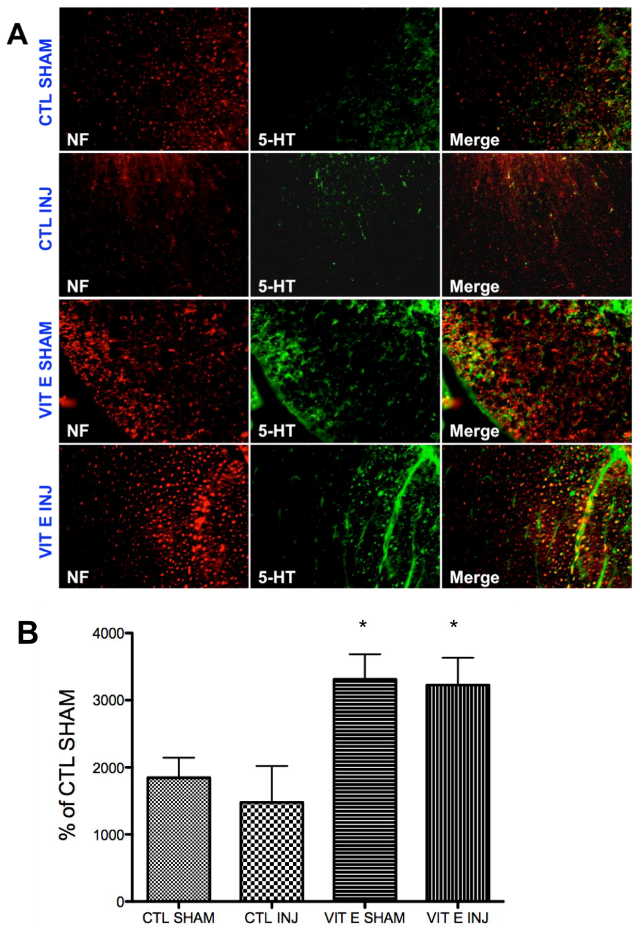 Brainsci 08 00038 g007