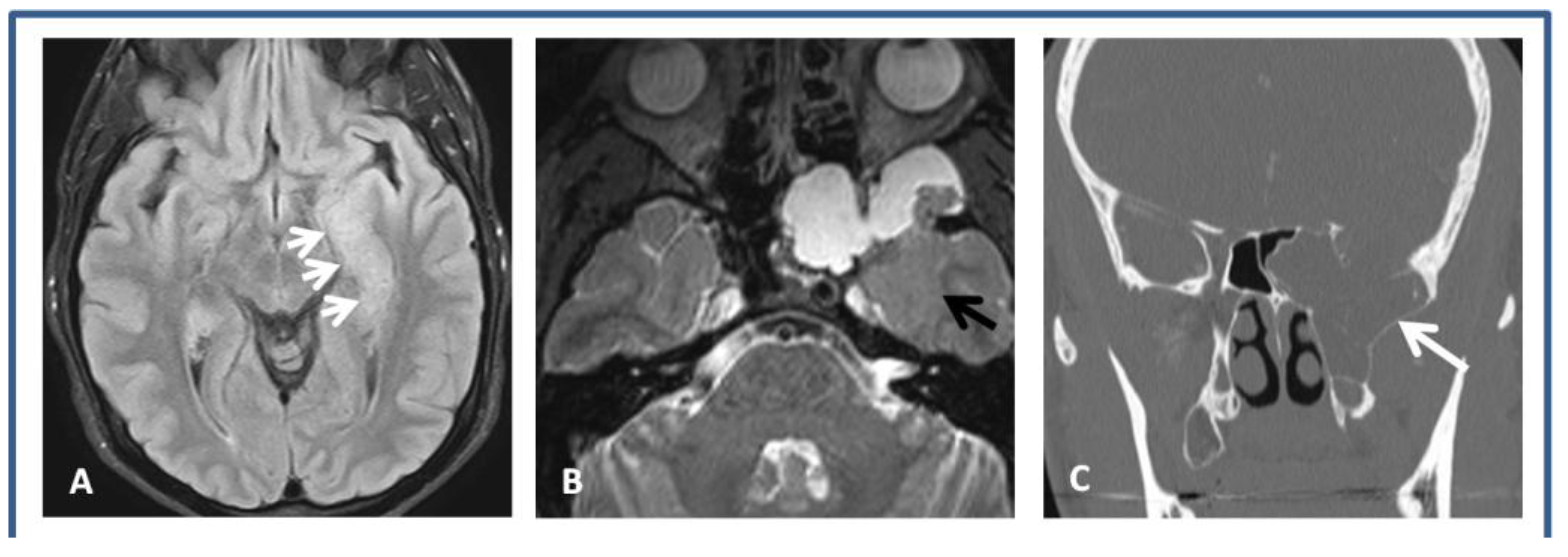 Brainsci 08 00042 g001 550