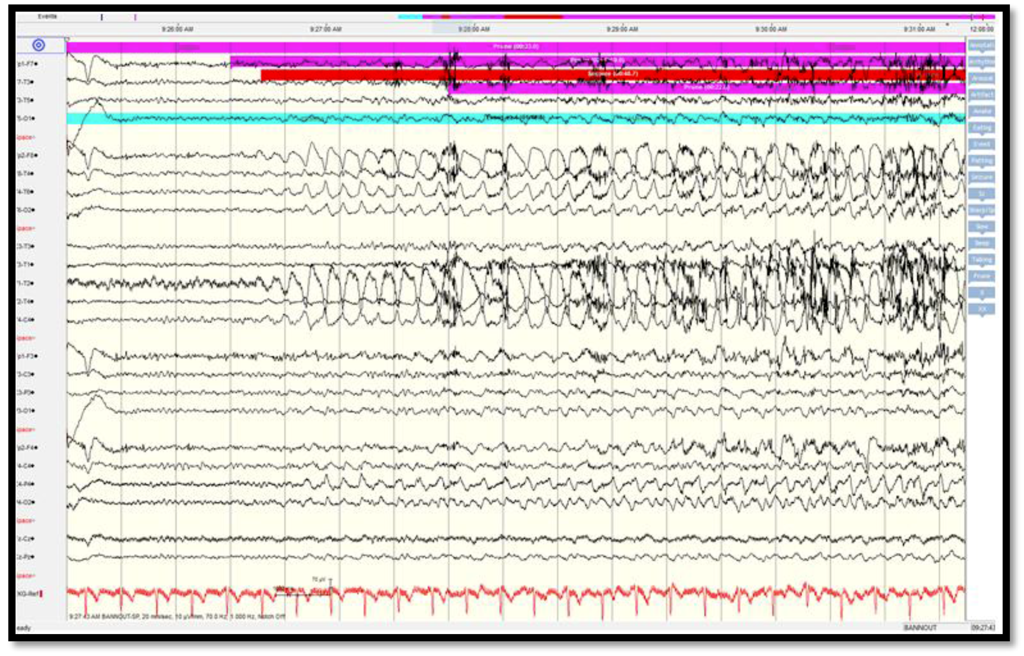 Brainsci 08 00042 g006 550