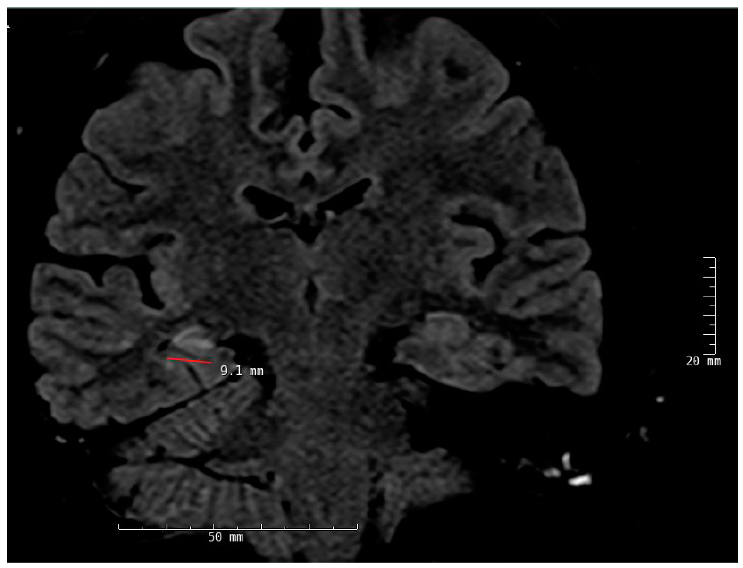 Brainsci 08 00049 g002 Brainsci 08 00049 g002