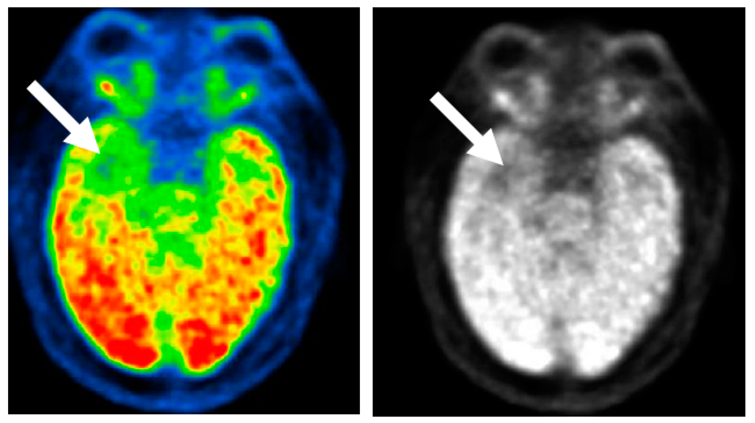 Brainsci 08 00049 g003 Brainsci 08 00049 g003