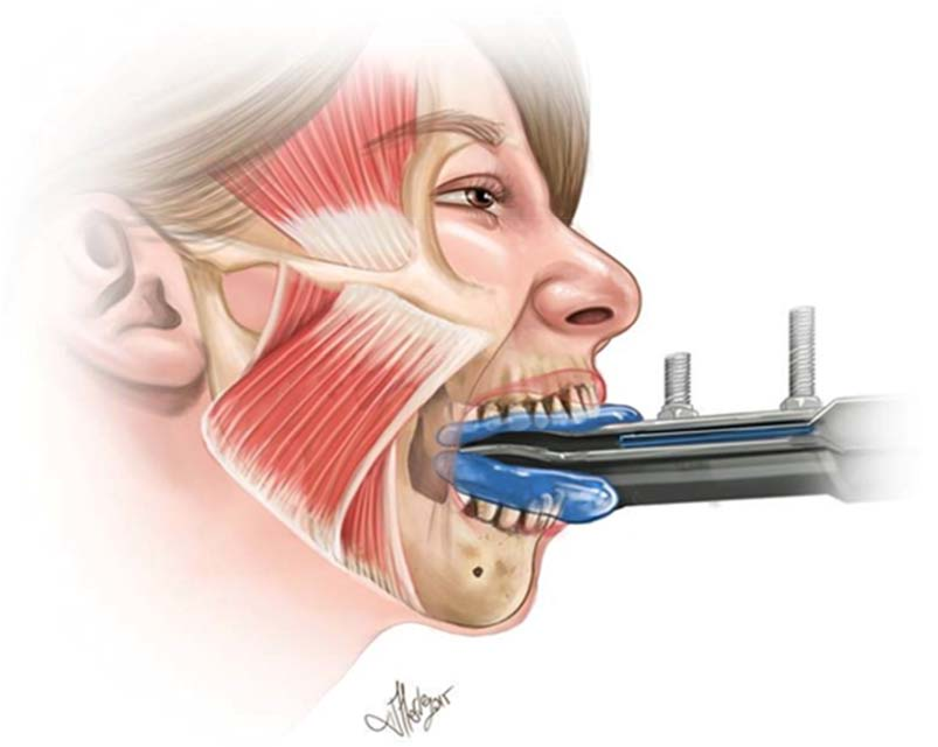 Brainsci 08 00076 g001