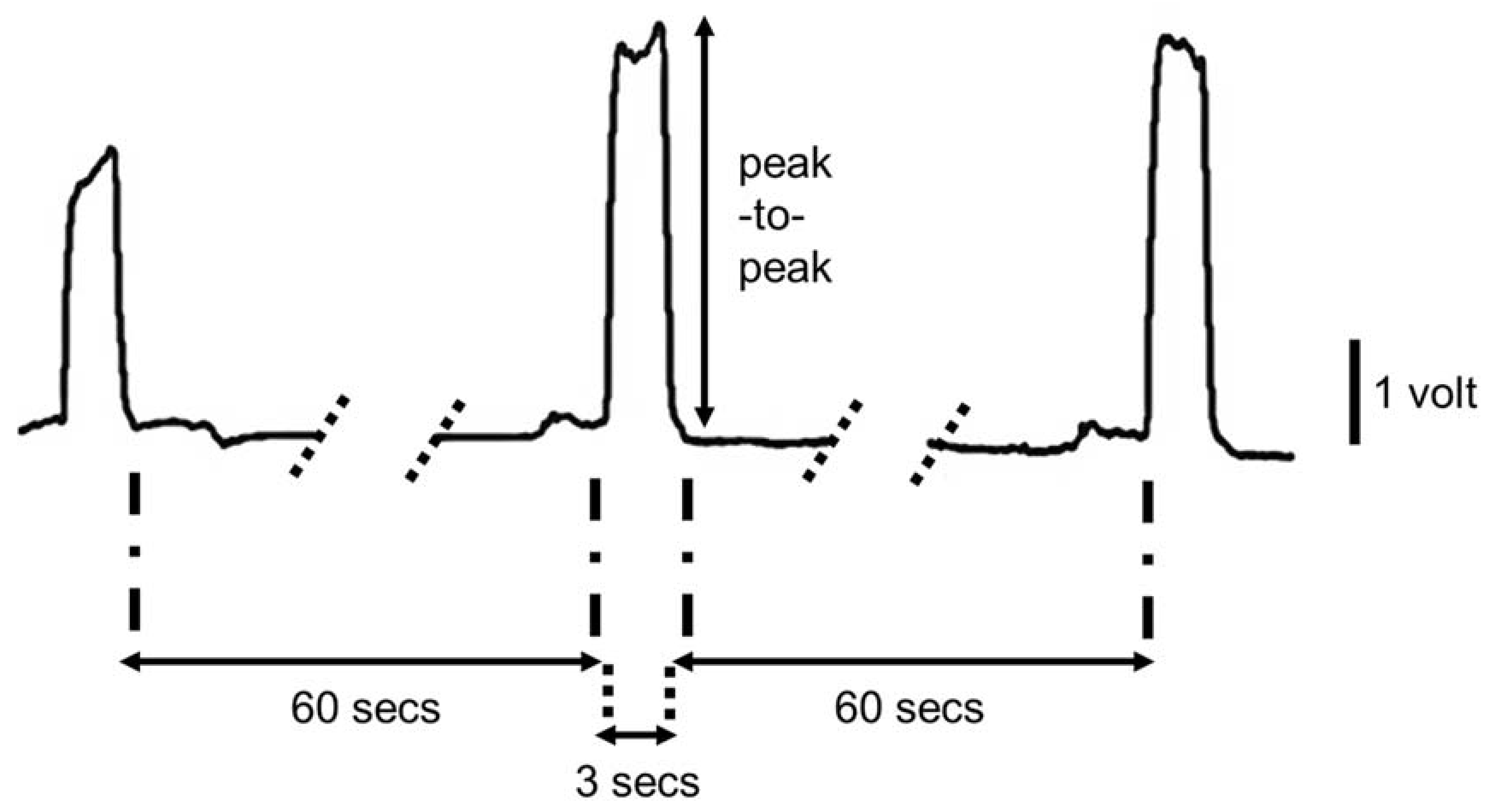 Brainsci 08 00076 g002