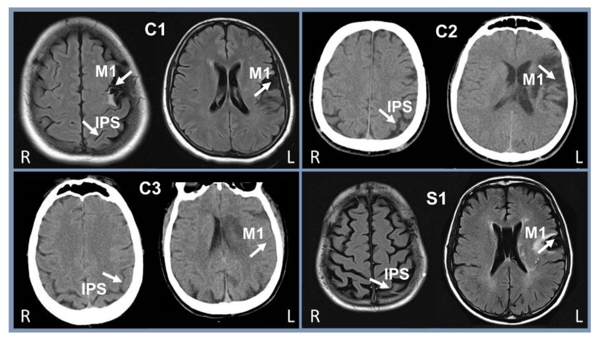 Brainsci 08 00078 g002 Brainsci 08 00078 g002