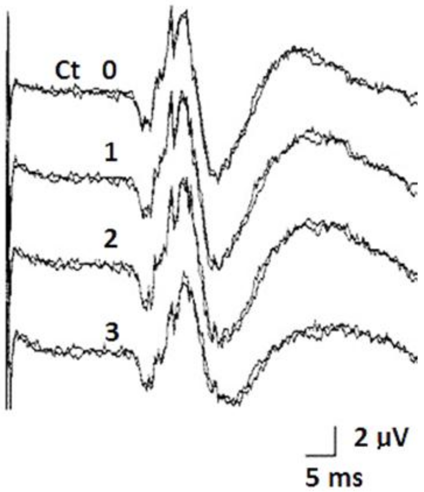 Brainsci 08 00090 g008