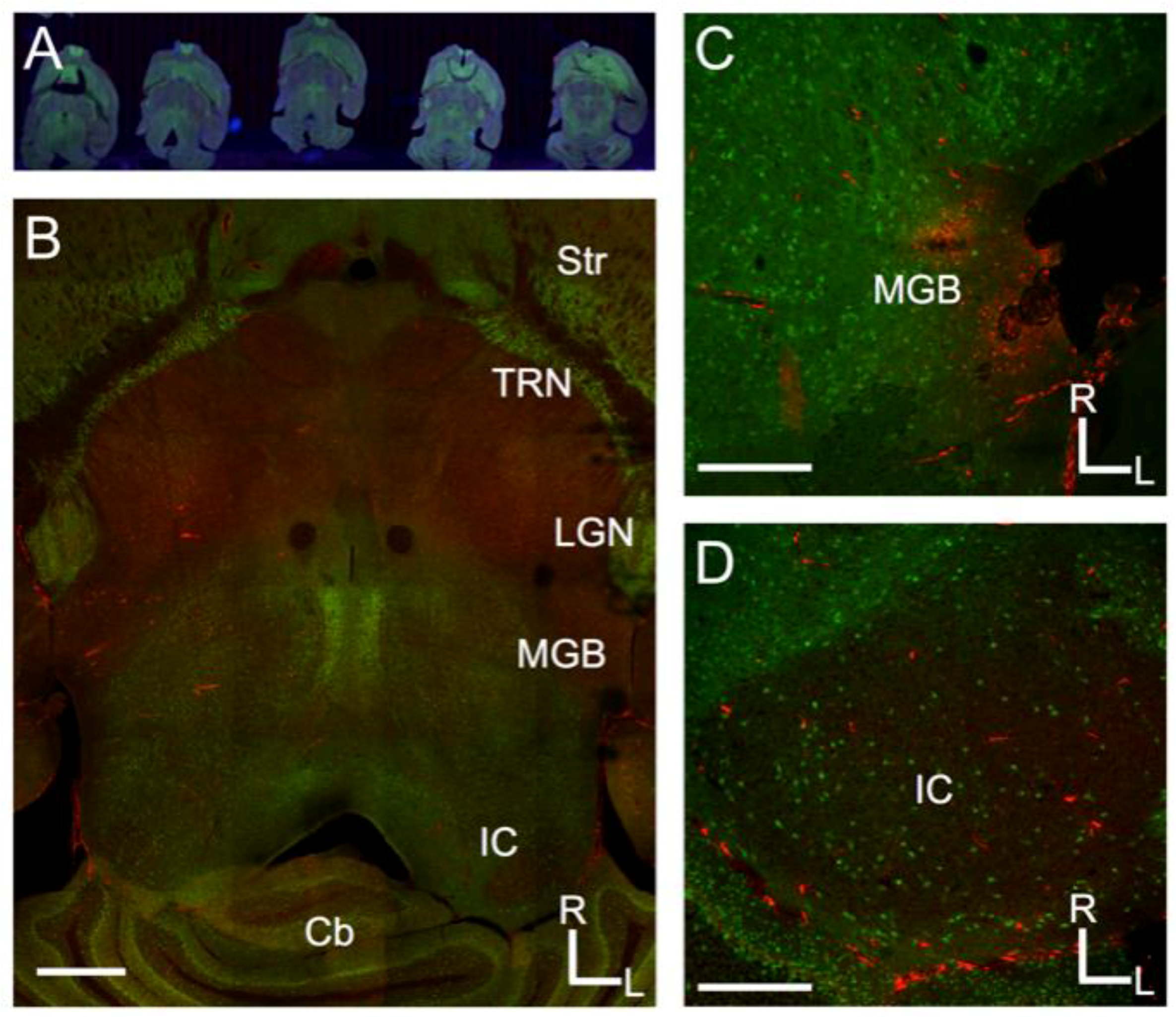 Brain Sciences Free Full Text Inhibitory Projections In The Mouse Auditory Tectothalamic System Html
